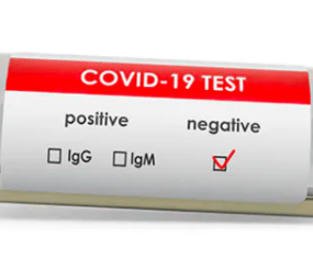 Negative COVID-19 Test Result 