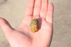 3 Ways to Check if You Have Gallstones